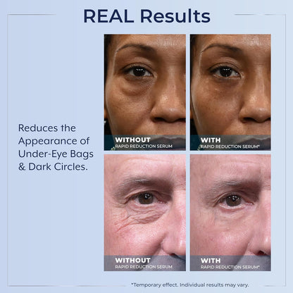Plexaderm@ Rapid Reduction Eye Serum - Visibly Reduces Under-Eye Bags