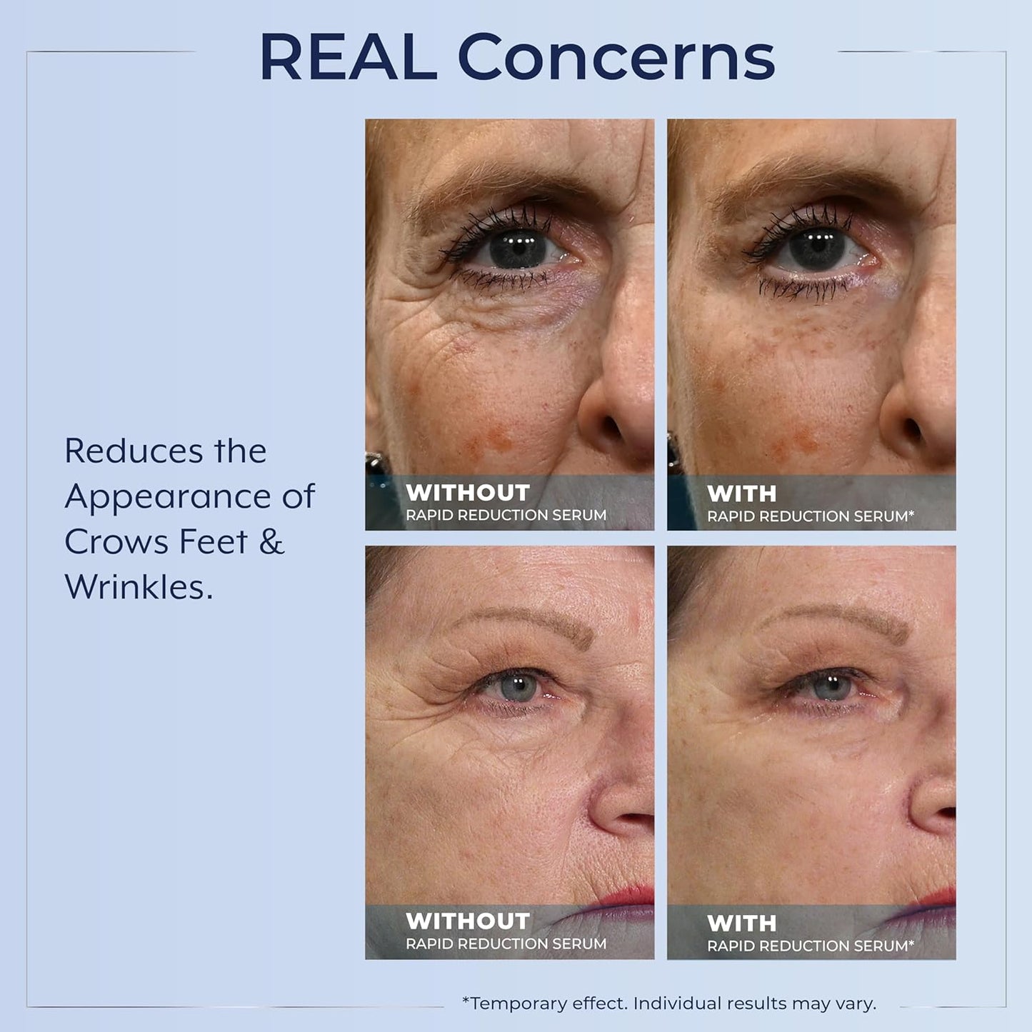 Plexaderm@ Rapid Reduction Eye Serum - Visibly Reduces Under-Eye Bags