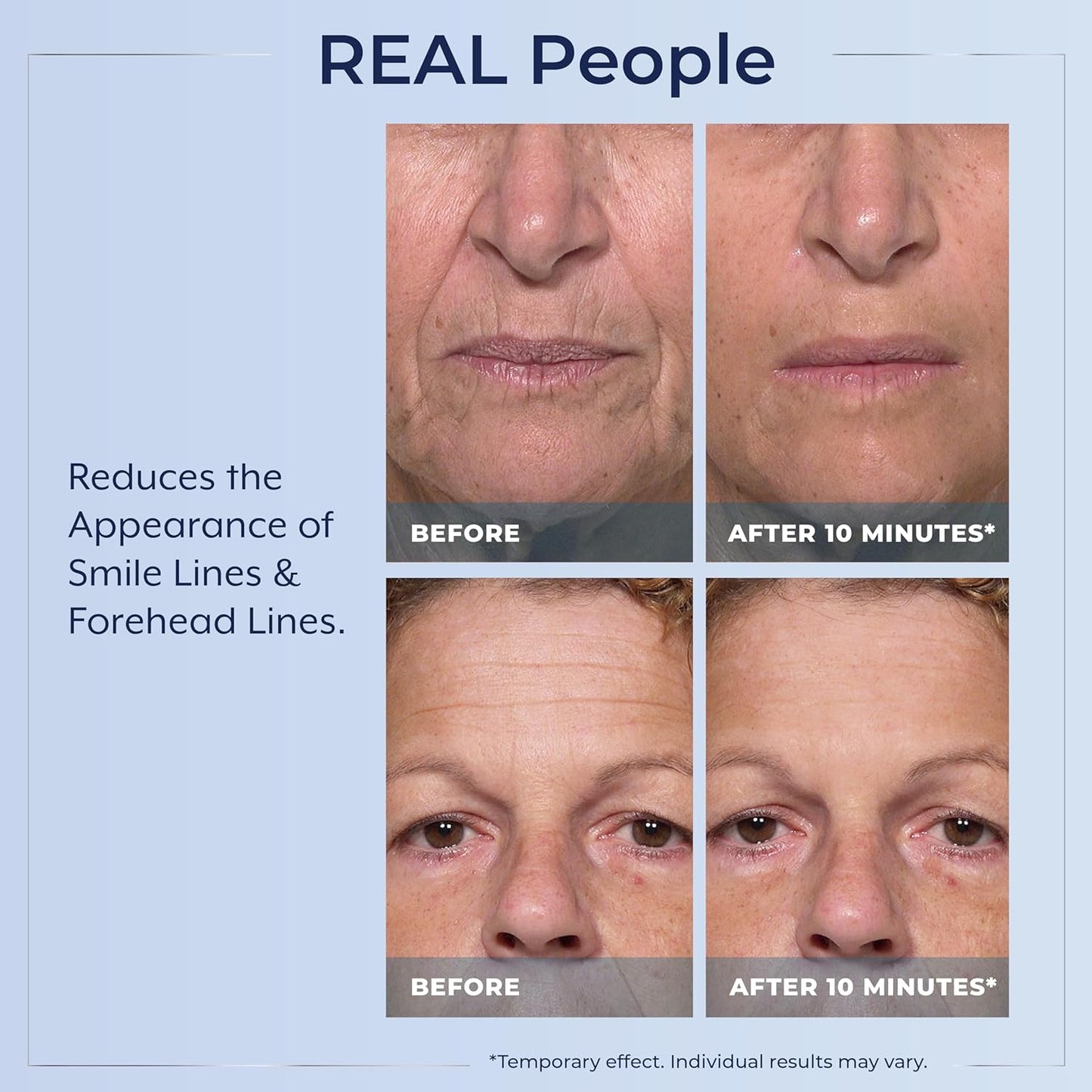 Plexaderm@ Rapid Reduction Eye Serum - Visibly Reduces Under-Eye Bags