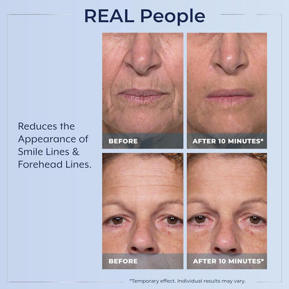 Plexaderm@ Rapid Reduction Eye Serum - Visibly Reduces Under-Eye Bags